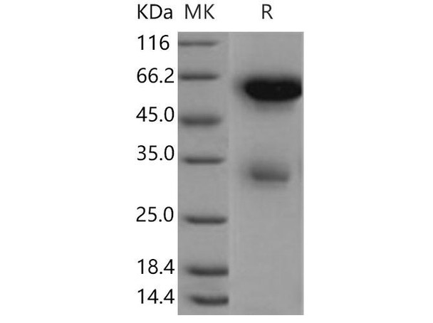 Mouse Legumain/LGMN Recombinant Protein (RPES2037)