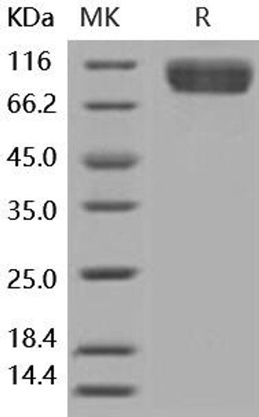 Human IL1RL1/ST2 Recombinant Protein (RPES2055)