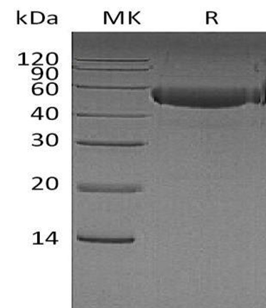 Human CTLA4 Recombinant Protein (RPES2060)