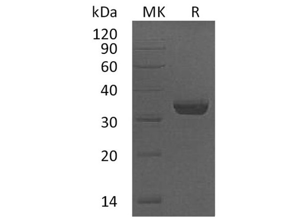Human LMAN2/VIP36 Recombinant Protein (RPES2069)