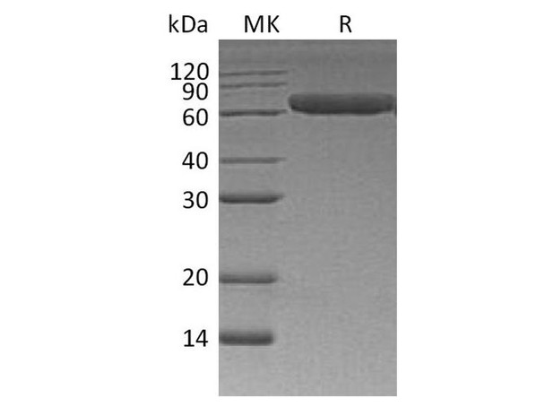 Human ROR1 Recombinant Protein (RPES2070)