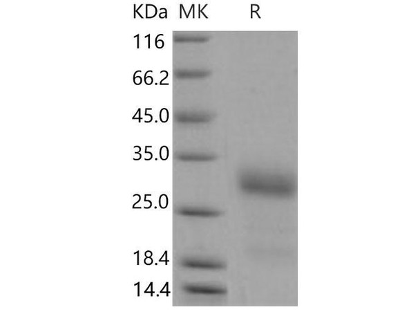 Mouse IGFBP6/IBP-6 Recombinant Protein (RPES2078)