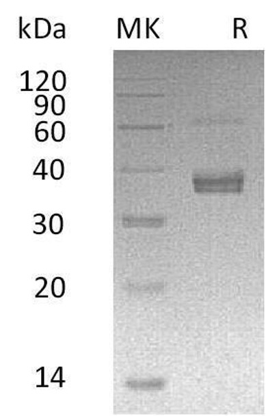 Human ADAMDEC1 Recombinant Protein (RPES2080)