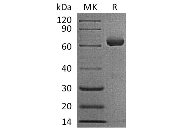 Human IGSF11/BTIGSF Recombinant Protein (RPES2112)