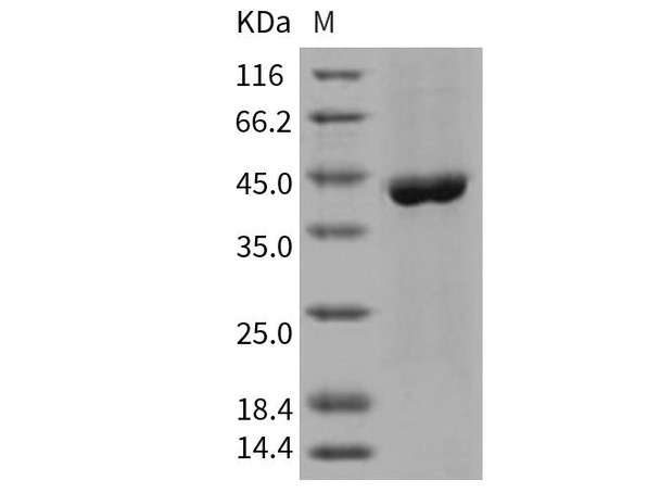 Human ACY1/Aminoacylase Recombinant Protein (RPES2117)