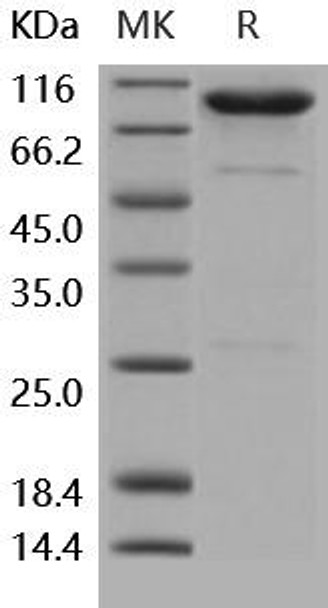 Human CD55/DAF Recombinant Protein (RPES2118)
