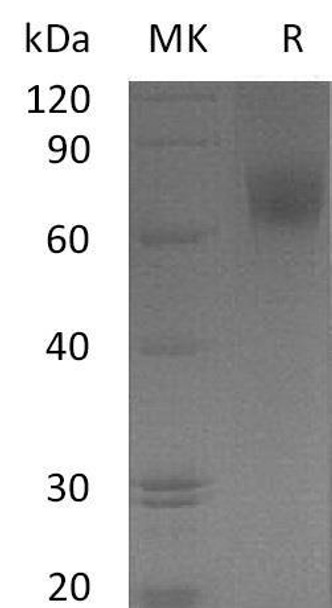 Human EGFR/ErbB1 Recombinant Protein (RPES2136)