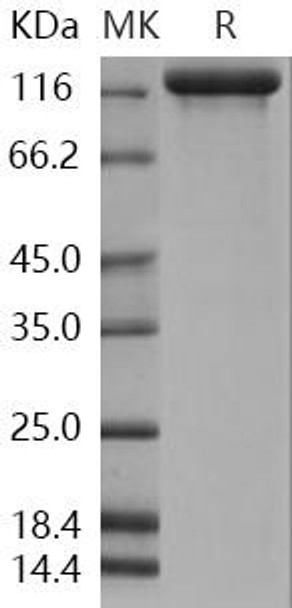 Human Semaphorin 5A/SEMA5A Recombinant Protein (RPES2137)