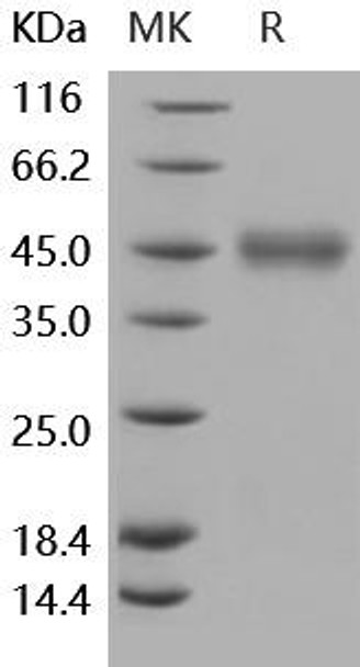 Human SLAMF5/CD84 Recombinant Protein (RPES2139)