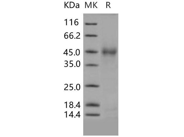 Human SFTPD/SP-D Recombinant Protein (RPES2142)