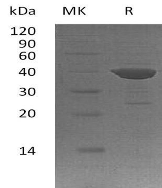 Human ADPRH/ARH1 Recombinant Protein (RPES2143)