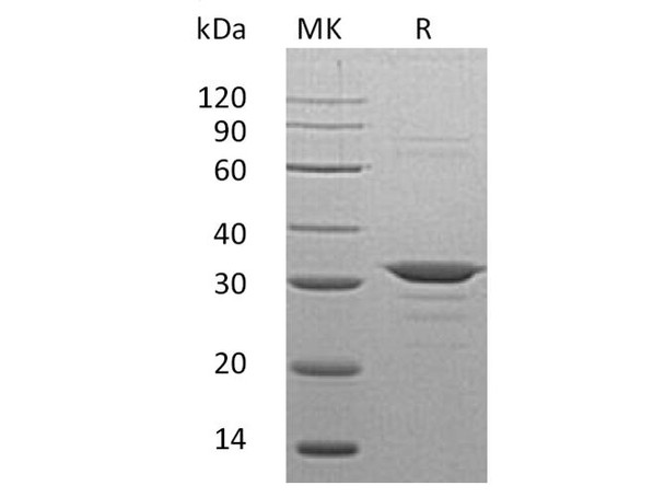 Human CLIC4 Recombinant Protein (RPES2154)