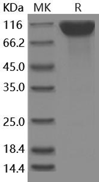 Human CD6/TP120 Recombinant Protein (RPES2157)