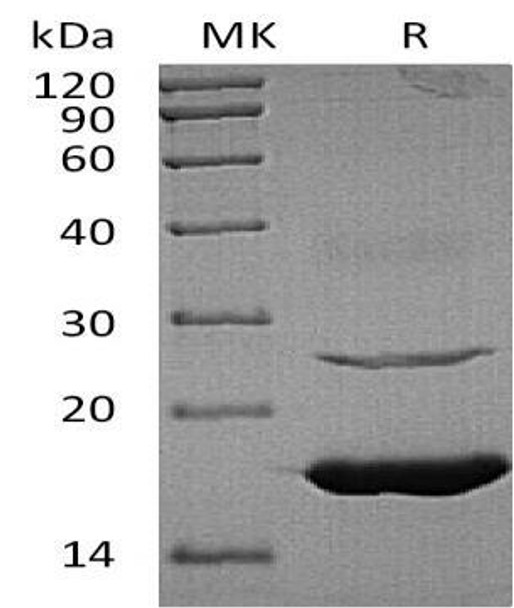 Human Ube2L6 Recombinant Protein (RPES2179)