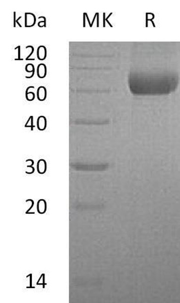 Human TMPRSS11B Recombinant Protein (RPES2186)