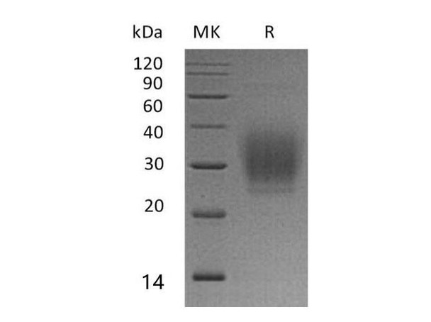 Human PTH1R Recombinant Protein (RPES2196)