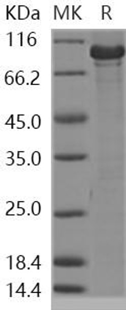 Human CHK2/CHEK2 Recombinant Protein (RPES2199)