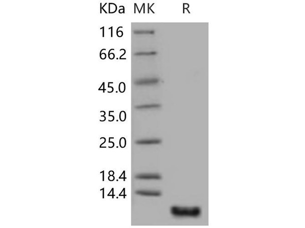 Human S100P/S100E Recombinant Protein (RPES2200)