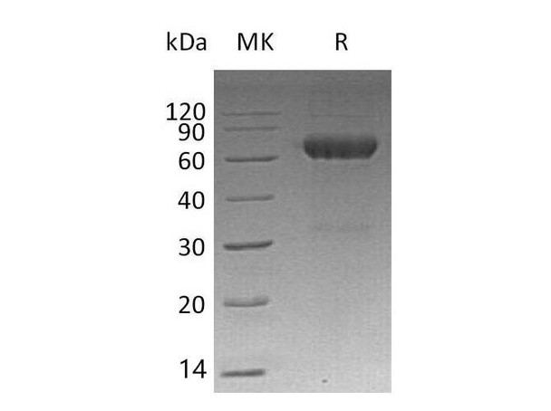 Mouse MMP12/MMP2/HME Recombinant Protein (RPES2213)