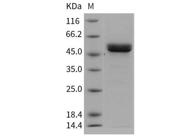 Human MMP1 Recombinant Protein (RPES2223)