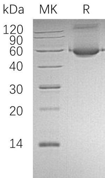 Human ALDH1A1/ALDC Recombinant Protein (RPES2227)