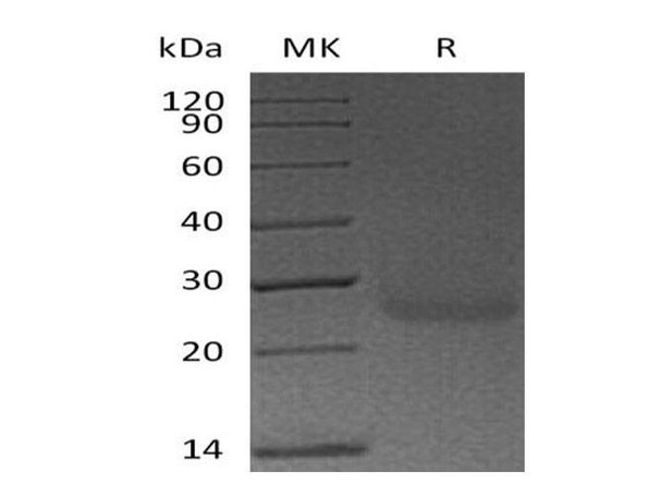 Human Podoplanin/PDPN Recombinant Protein (RPES2230)