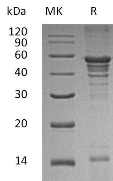 Human UBA5 Recombinant Protein (RPES2231)