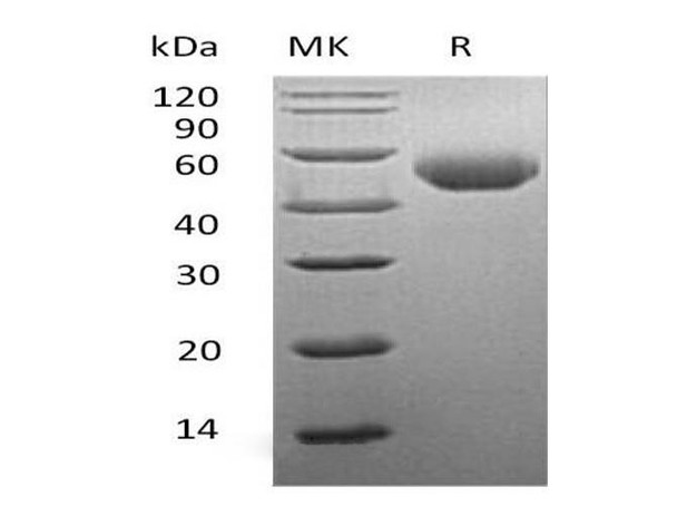Mouse SerpinA1/A1AT Recombinant Protein (RPES2239)