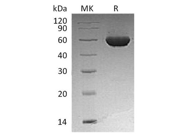 Human ALDH1A2 Recombinant Protein (RPES2248)