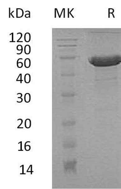 Human Dermatopontin/DPT Recombinant Protein (RPES2249)
