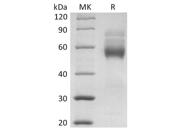 Human HVEM/TNFRSF14 Recombinant Protein (RPES2259)