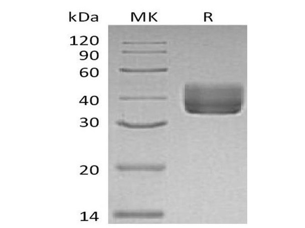 Mouse CD157/BST1 Recombinant Protein (RPES2260)