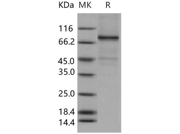 Human ELK1 Recombinant Protein (RPES2261)