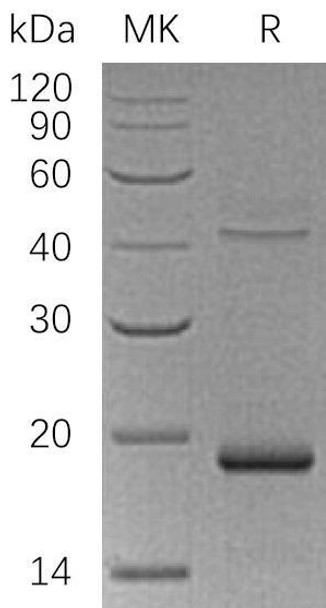 Human UPP1 Recombinant Protein (RPES2291)