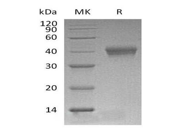 Mouse CD38 Recombinant Protein (RPES2299)