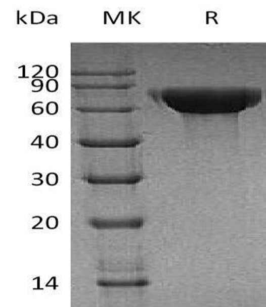 Human CNDP1 Recombinant Protein (RPES2304)