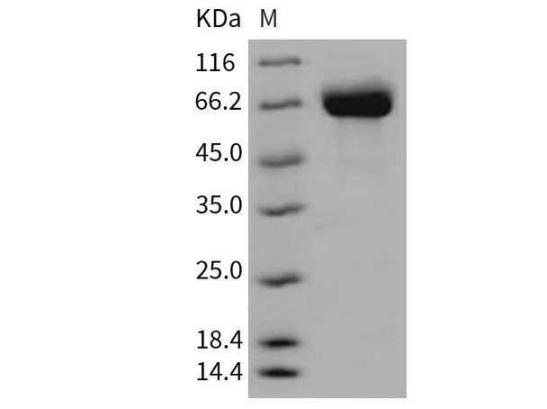 Mouse BCHE Recombinant Protein (RPES2306)