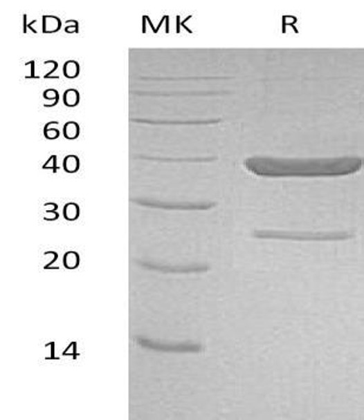 Human AKR1C4 Recombinant Protein (RPES2308)