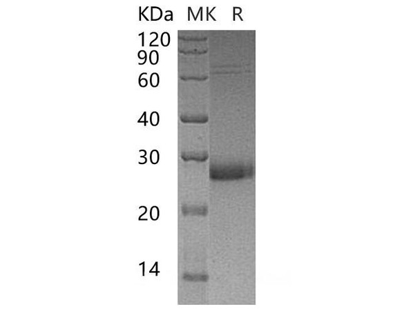 Human Uroplakin-2/UPK2 Recombinant Protein (RPES2312)