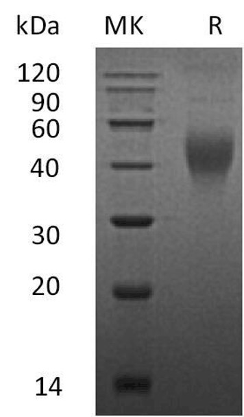 Mouse M-CSF/CSF1 Recombinant Protein  (RPES2314)
