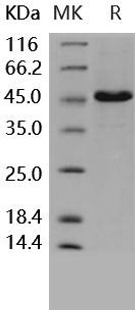 Human CD4/LEU3 Recombinant Protein (RPES2321)