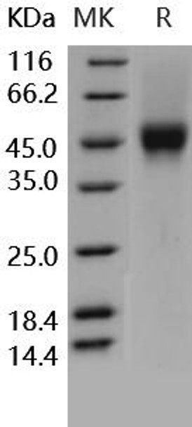 Human CD16a/FCGR3A Recombinant Protein (RPES2327)