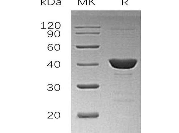 Human UROD Recombinant Protein (RPES2333)