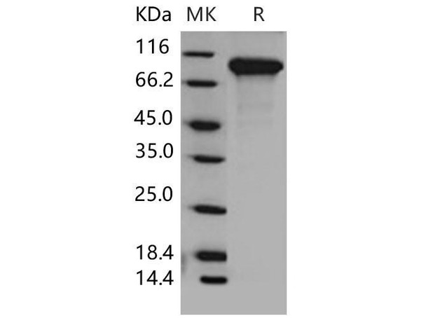 Mouse DDR2 Kinase/CD167b Recombinant Protein (RPES2334)