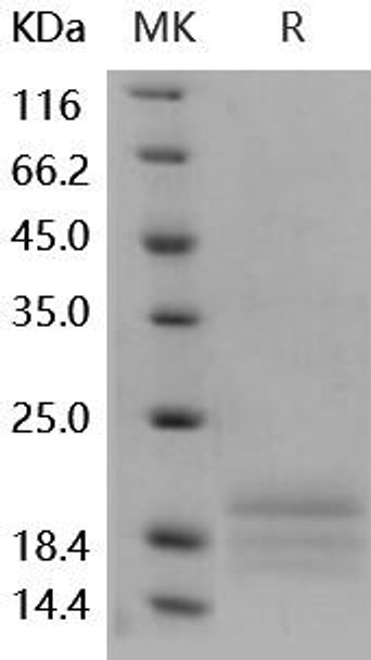 Human AgRP/AGRP Recombinant Protein (RPES2346)