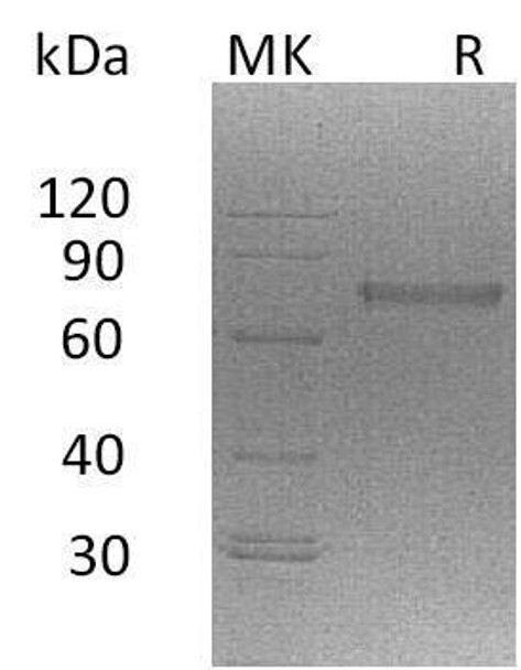 Mouse NCR1 Recombinant Protein (RPES2357)