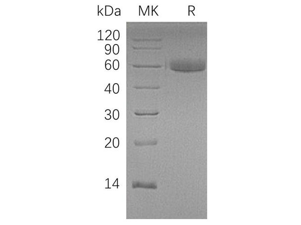 Human HAO1 Recombinant Protein (RPES2362)