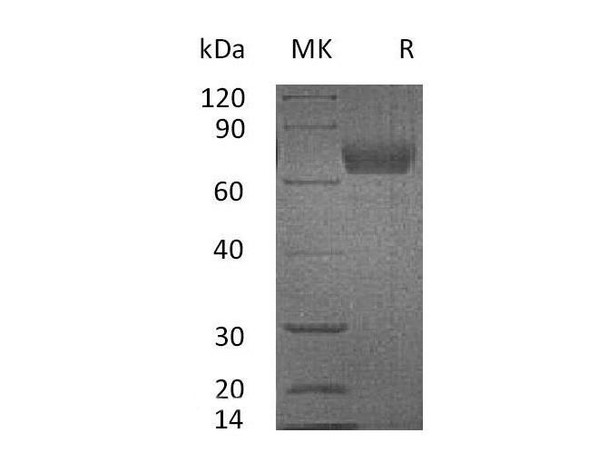 Mouse IL4RA/CD124 Recombinant Protein (RPES2364)