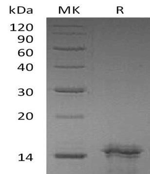 Human Interleukin-31/IL-31 Recombinant Protein (RPES2376)