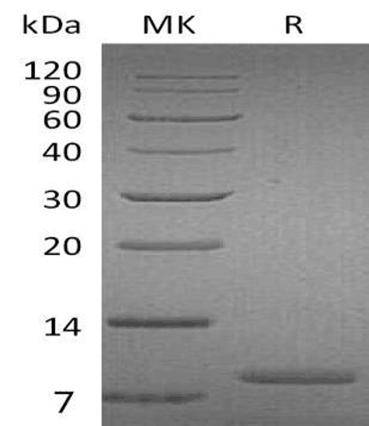 Human UGRP1 Recombinant Protein (RPES2378)